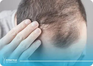 همه چیز درباره ترمیم مو HRP