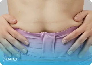 چرا ورم بعد لیپوماتیک ممکن است یک تا دو هفته باقی بماند؟