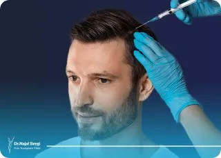 مزوتراپی مو، بهترین دارو تقویتی بعد از کاشت مو + زمان و نحوه مصرف