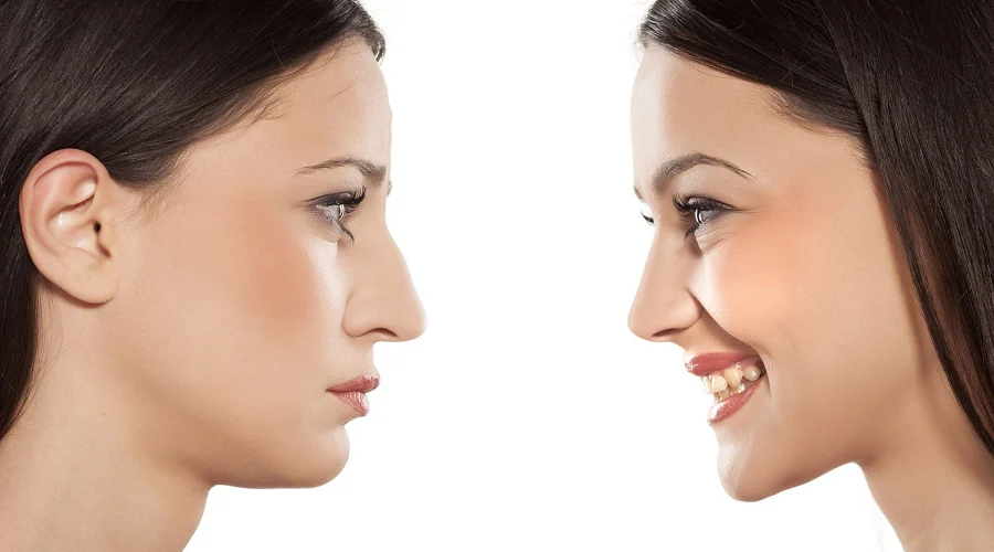 چه کسانی برای جراحی بینی مناسب هستند؟ نکات مهم پیش از عمل