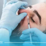 اصلاح قوز بینی با جراحی و بدون جراحی
