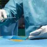 ابدومینوپلاستی و پوست ترک‌ خورده: چگونه می‌توان افتادگی پوست را کاهش داد؟