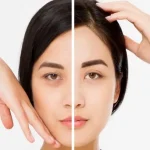 چه مدت بعد از لیفت ابرو می‌توان به فعالیت‌ های روزمره بازگشت؟