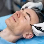 رابطه بین نوع ابرو و روش لیفت؛ چه فرم‌هایی نیازمند چه تکنیکی هستند؟