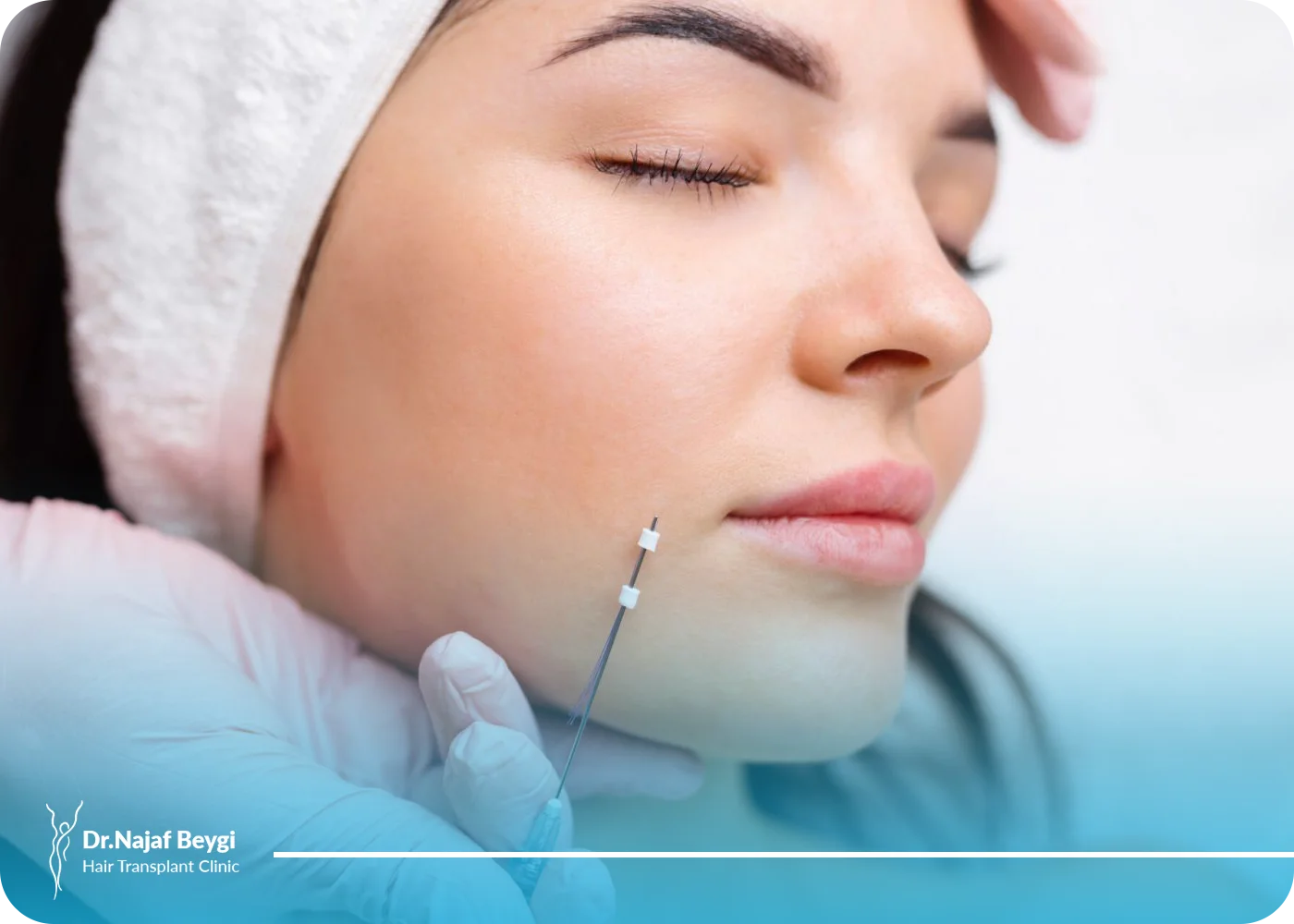 چال گونه با نخ یا با جراحی؟ کدام انتخاب بهتری است؟
