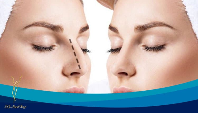 ویژگی های بهترین جراح بینی استخوانی در تهران